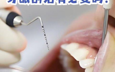 口腔科HSK刮治是什么？有必要吗？疼不疼？